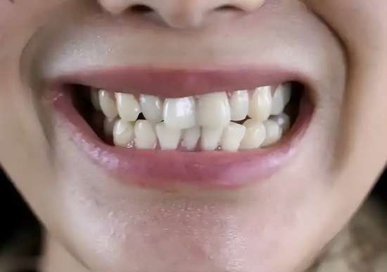 研究发现经常午睡的人