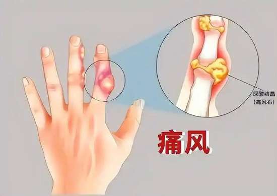 医生专家讲每天吃21种食物