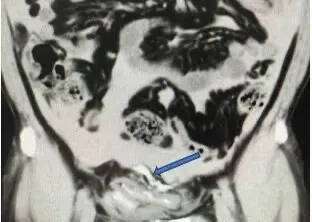广州一男子戒酒被打