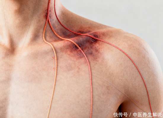 推拿可以放松肩颈吗