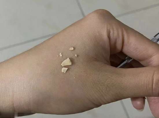 每顿饭吃完都要漱口吗