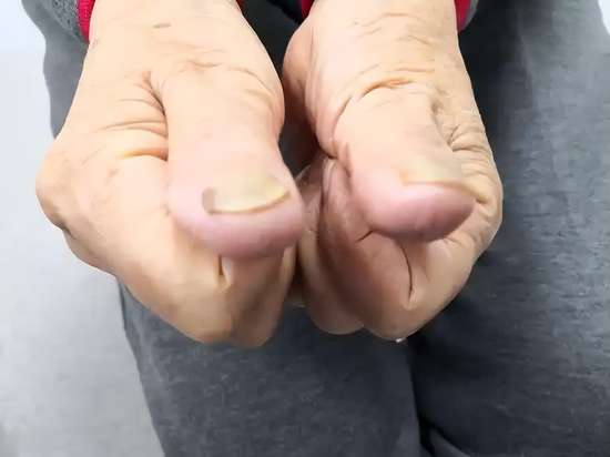 医生怀疑恶性肿瘤的可能性有多大