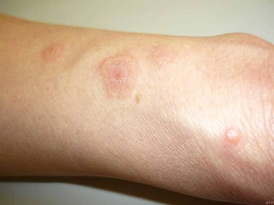 人不会无故患糖尿病的原因