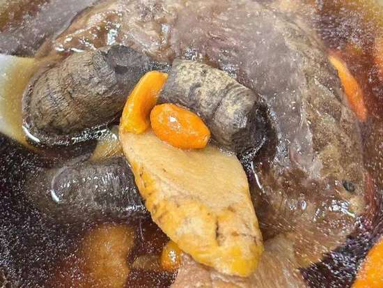 肾气不足需要补肾吗