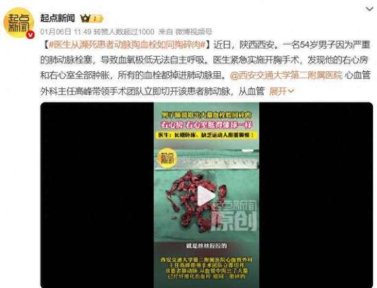 从血管里取出血栓是怎么回事