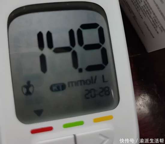 医生提醒血糖高不高看手就知道