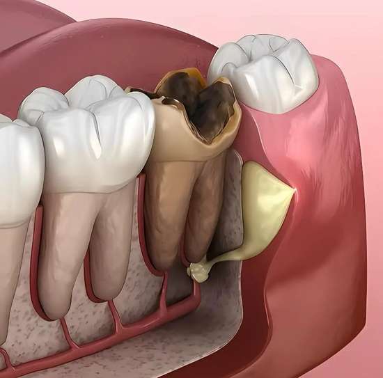 牙齿受伤最佳补救方法
