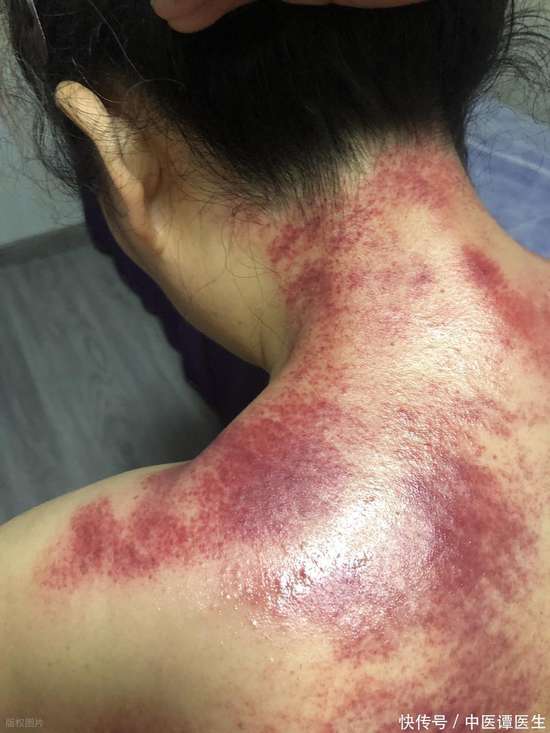 老祖宗留下来的刮痧经典老话