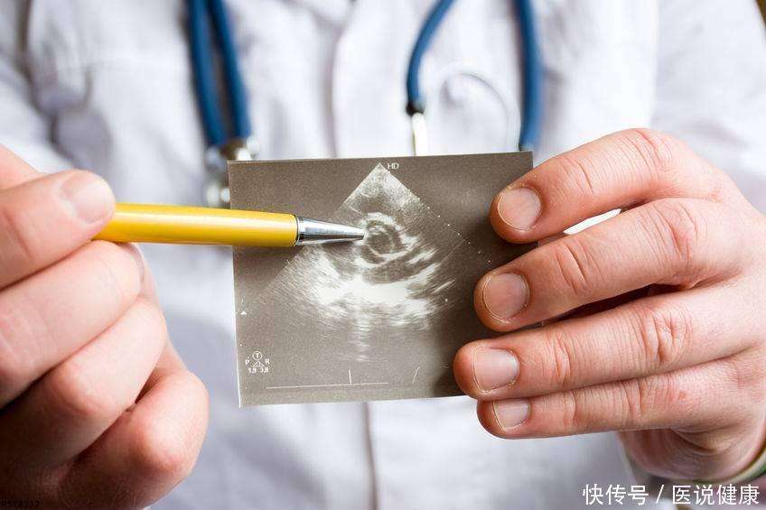 什么是“阴式b超”？提醒女性：做这一检查前需牢记这4点！播报文章
