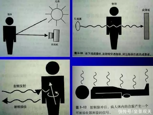 人死前3天灵魂已走（人临死前灵魂会到处跑吗） 第7张