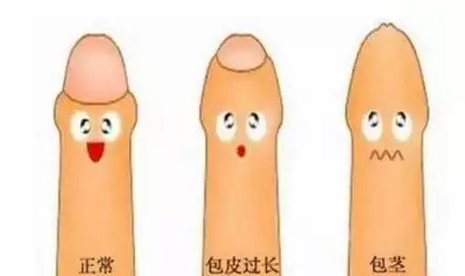 暑假到了,要不要给男孩割包皮?听听妇幼医生怎么说9岁女孩放学路上失踪,10年后在邻居家发现,父母哭到崩溃