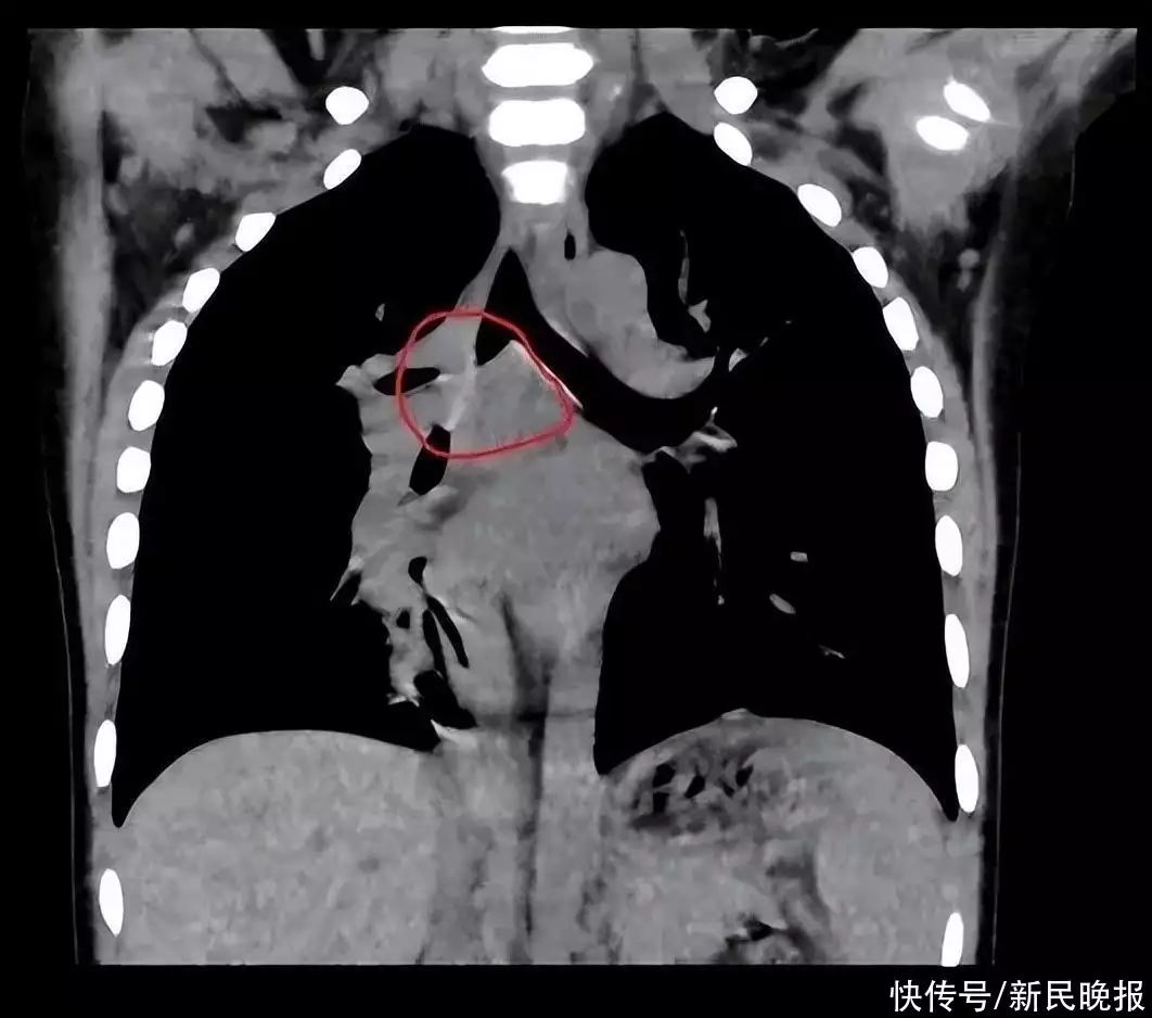 西瓜子（瓜子对身体的好处和坏处有哪些图片） 第5张