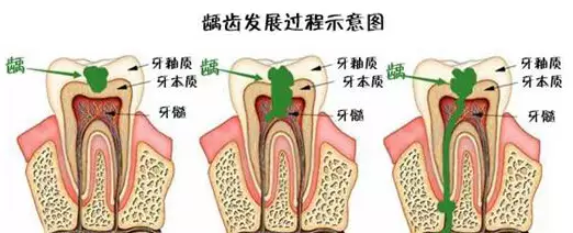 怎么呵护口腔健康？听听专家怎么说还记得20多年前的“篮球女孩”吗？如今生活已大变样，众人替她高兴