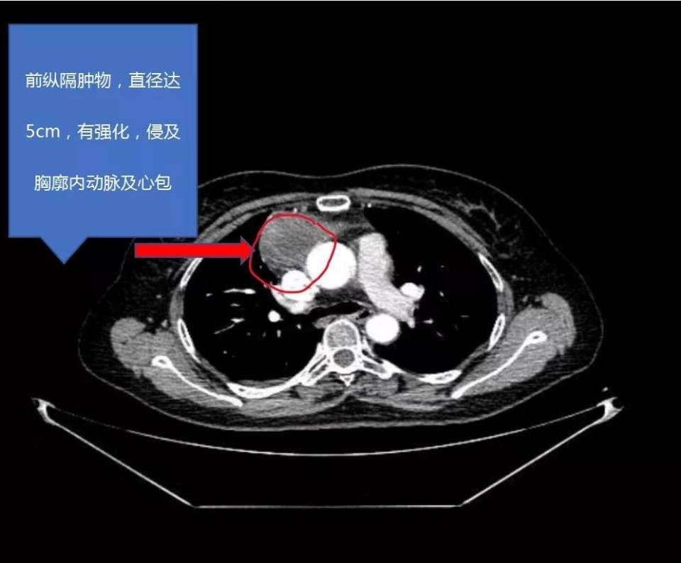 胸外科门诊：一场与生命搏斗的前线战斗