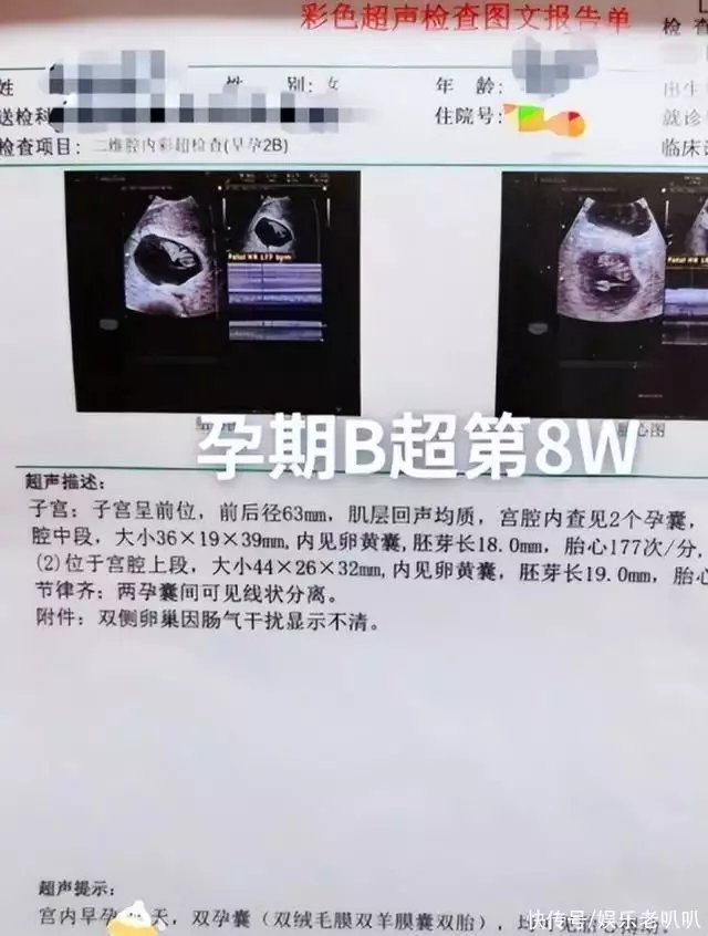 学到了（制造假怀孕报告单怎么弄）制造假怀孕报告单怎么弄出来的 第2张