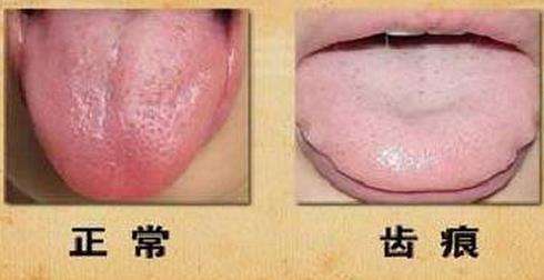 观舌识病:22种舌诊图解大全,通过舌头认识自己的身体状况_【快资讯】