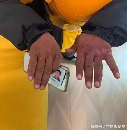 送餐老赵回应3年赚102万:送现铜多,不希望大家模仿,要未雨绸缪林宏吉三两酒,天天一袋烟,不听医生劝告的演员王之卓,现在怎么样了(图3) 送餐老赵回应3年赚102万:送现铜多,不希望大家模仿,要未雨绸缪林宏吉三两酒,天天一袋烟,不听医生劝告的演员王之卓,现在怎么样了(图3)