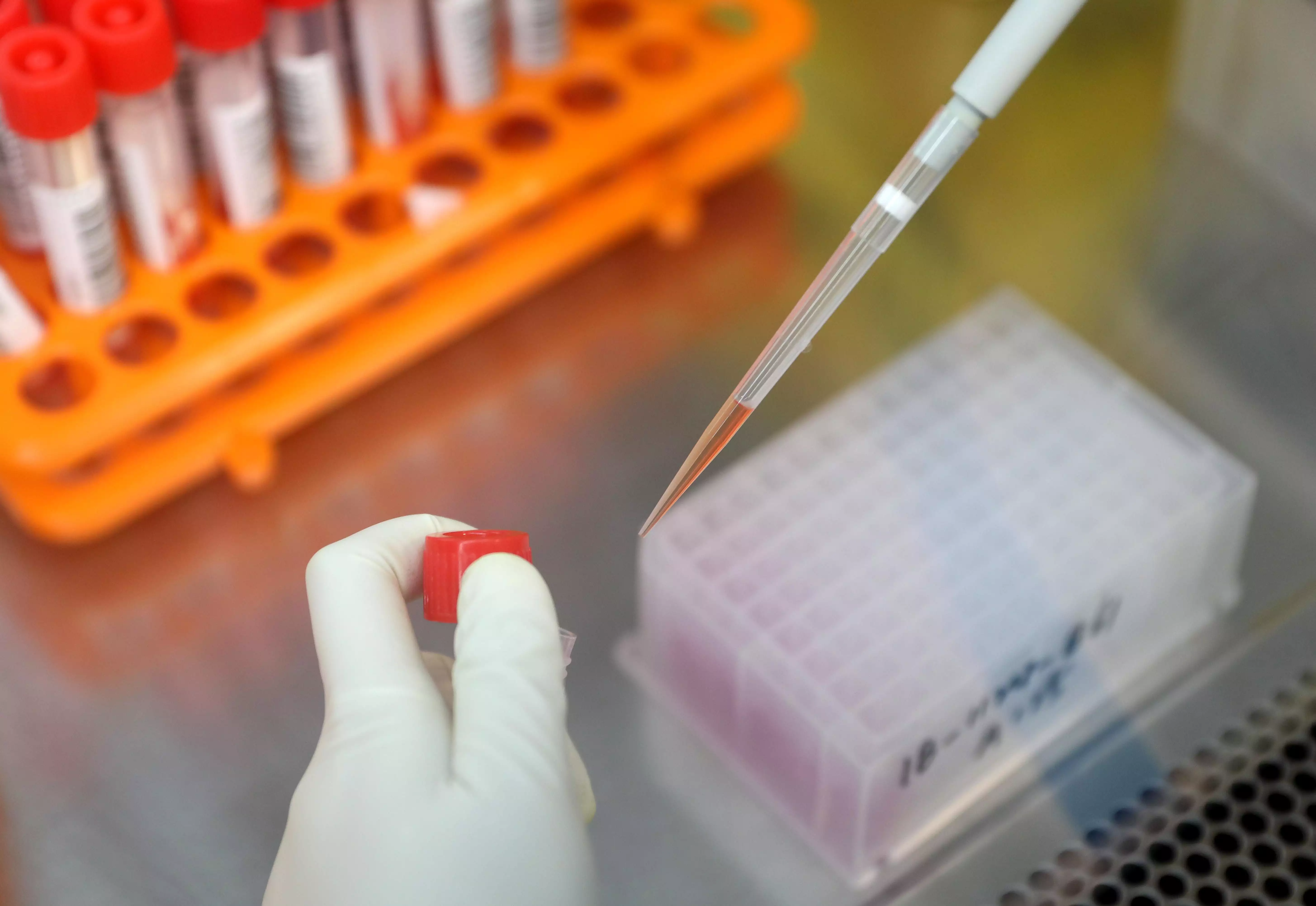 北京东城区新增1名感染者，风险点位公布，涉及KTV、烤鸭店等大衣哥朱之文心凉了，一怒之下公布村民8年来的欠条，金额吓人