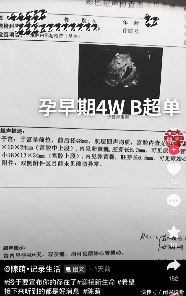 这样也行？（女生假怀孕证明）做假怀孕证明 第3张