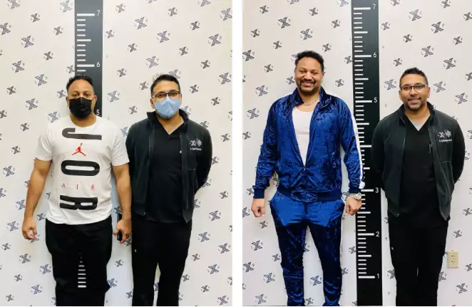 美国男子贷款50万断骨增高7厘米，医生：男性整形变得更普遍-美国断骨增高手术paley