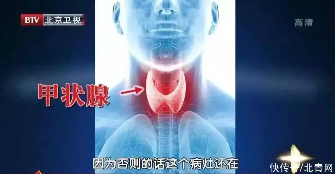 门徒娱乐app（甲状腺疾病高发，多是因为这3种体质！专家独创护甲消瘿法，消结节、抑甲亢被央视点名表扬的4部剧，每一部都是爆款，你最喜欢哪部？）