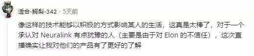 瘫痪8年用意念玩《文明6》,脑机接口真的要实现了?入冬最美皮草外套,高级、时髦又贵气 瘫痪8年用意念玩《文明6》,脑机接口真的要实现了?入冬最美皮草外套,高级、时髦又贵气