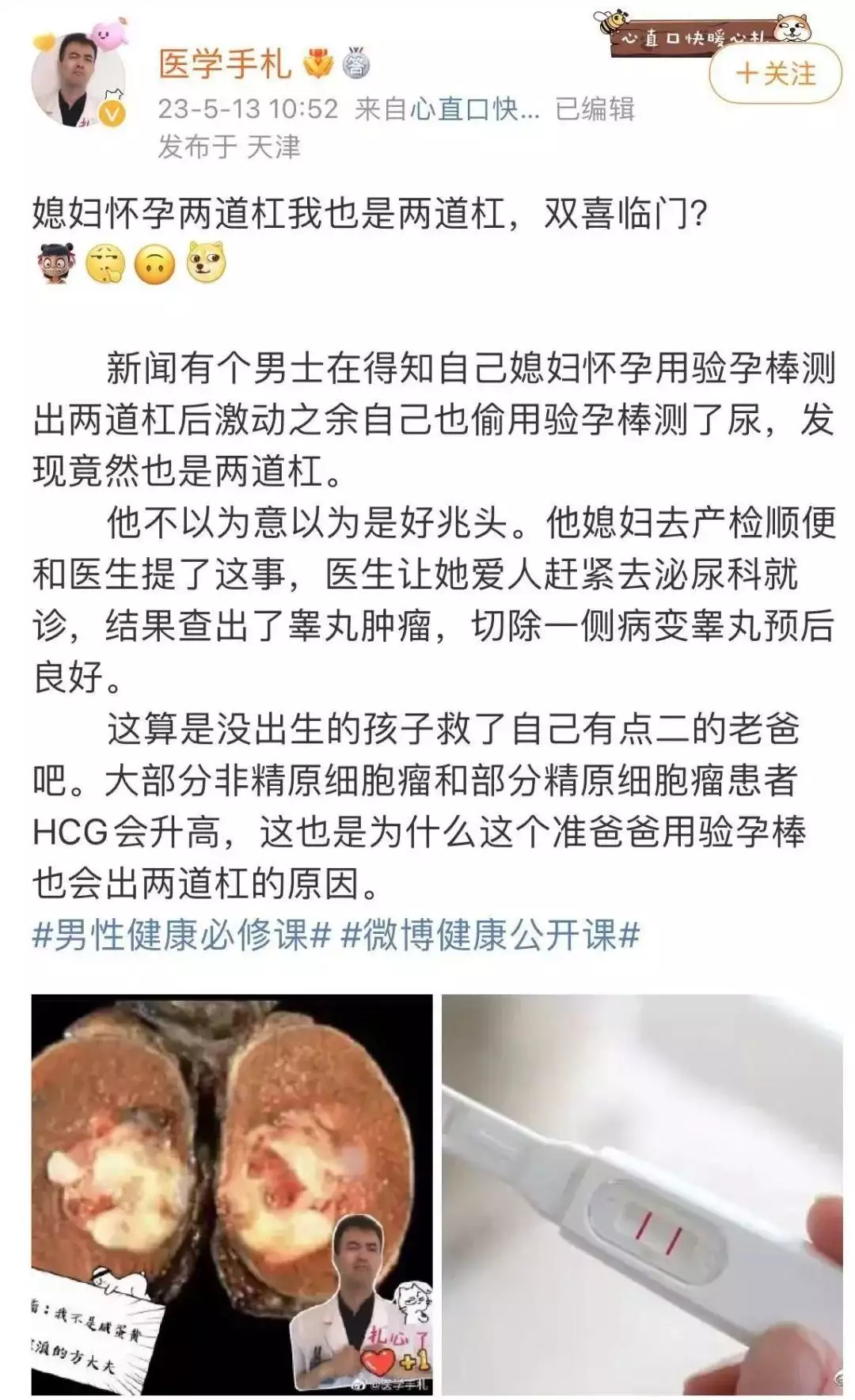 男子用验孕棒查出睾丸癌？医生：摸摸自己更管用这一次，47岁的李小冉，终于走到了这一步 第2张