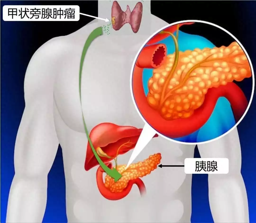 声东击西！明明是肚子痛，问题却出在脖子上男子名字太特殊，警察：你不改名，全国人口信息系统就得彻底更改（内科急腹症）声东击西是什么意思?，