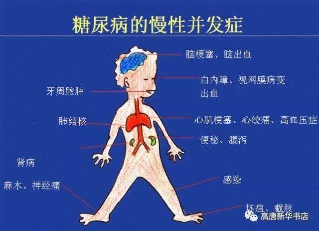 糖尿病的健康宣教 【快资讯】