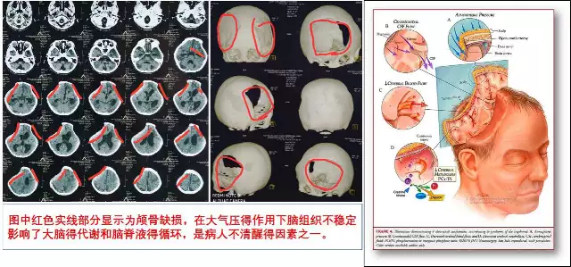 4949澳门开奖免费大全49图库,9岁男童脑外伤昏迷1年 迷走神经刺激术带来新希望播报文章