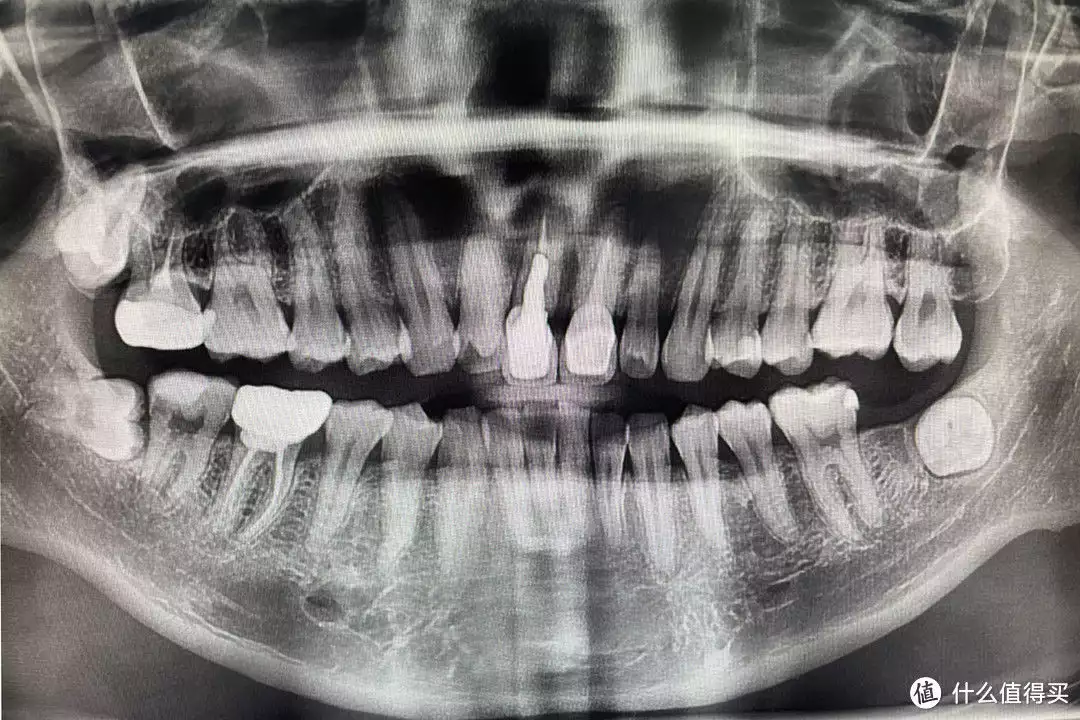 学到了吗（刷牙vlog）刷刷牙视频，智慧新选择，刷牙更轻松，usmile笑容加P10PRO牙刷白鹿穿吊带裙纯欲感十足 绿色挑染长发个性吸睛，6061铝合金，剪辑方法包括，