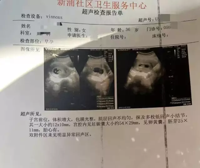 干货满满（假怀孕流产证明吗）假怀孕流产如何躲过医院检查 第4张