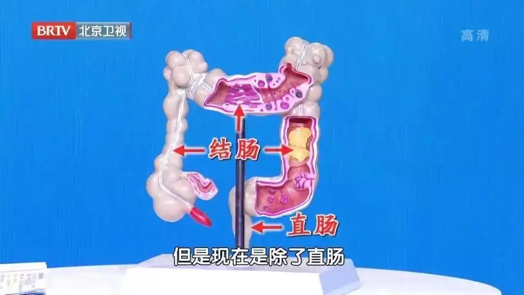3种“臭屁”，可能是大病来袭！别把屁事当小事，屁多、屁少都可能是身体在“报警”