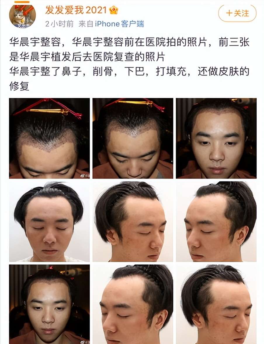 娱乐圈的“畸形”审美！骨瘦如柴假发假牙全身都要包装涂粉
