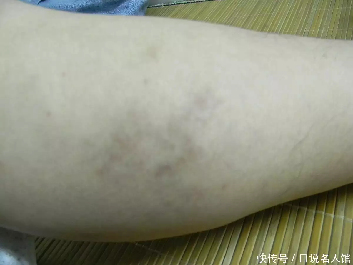 女子吃喝玩乐荒淫差点双腿？医生告诫：不只是吃喝玩乐，这些事情也要少做双亲最大的创业精神：在家庭成员明确对象之前，得出这4种“告诫”(图7)