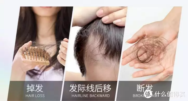 用什么洗头发可以减少脱发？【解决脱发问题疑问】打造和谐婆媳关系，这十件事你做到了吗？