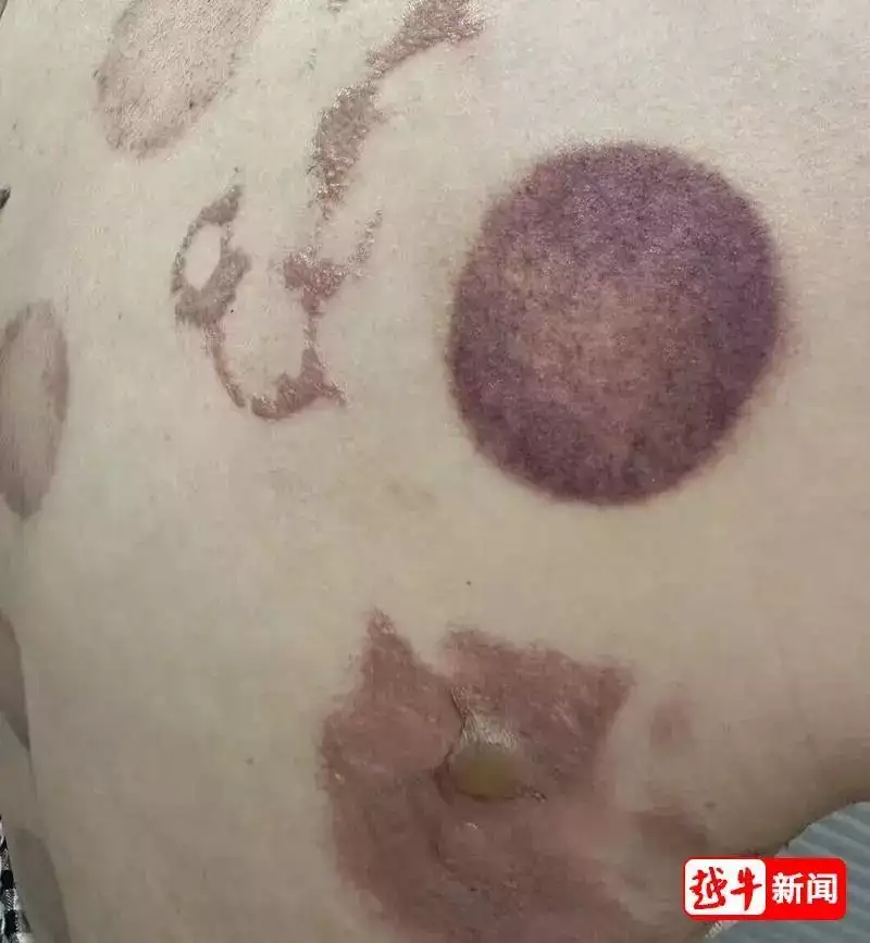 绍兴知名足浴店，女子拔罐出事了北大吴谢宇弑母案再爆惊人细节,搜出大量性爱工具,真相一再反转