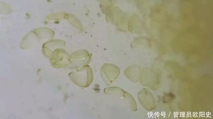 河蚌（河蚌的功效与作用） 第7张