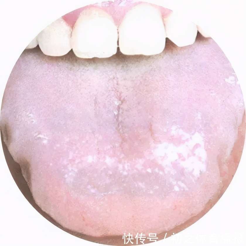 舌头有这些表现,说明身体出现问题了,中医教你观舌知病_【快资讯】