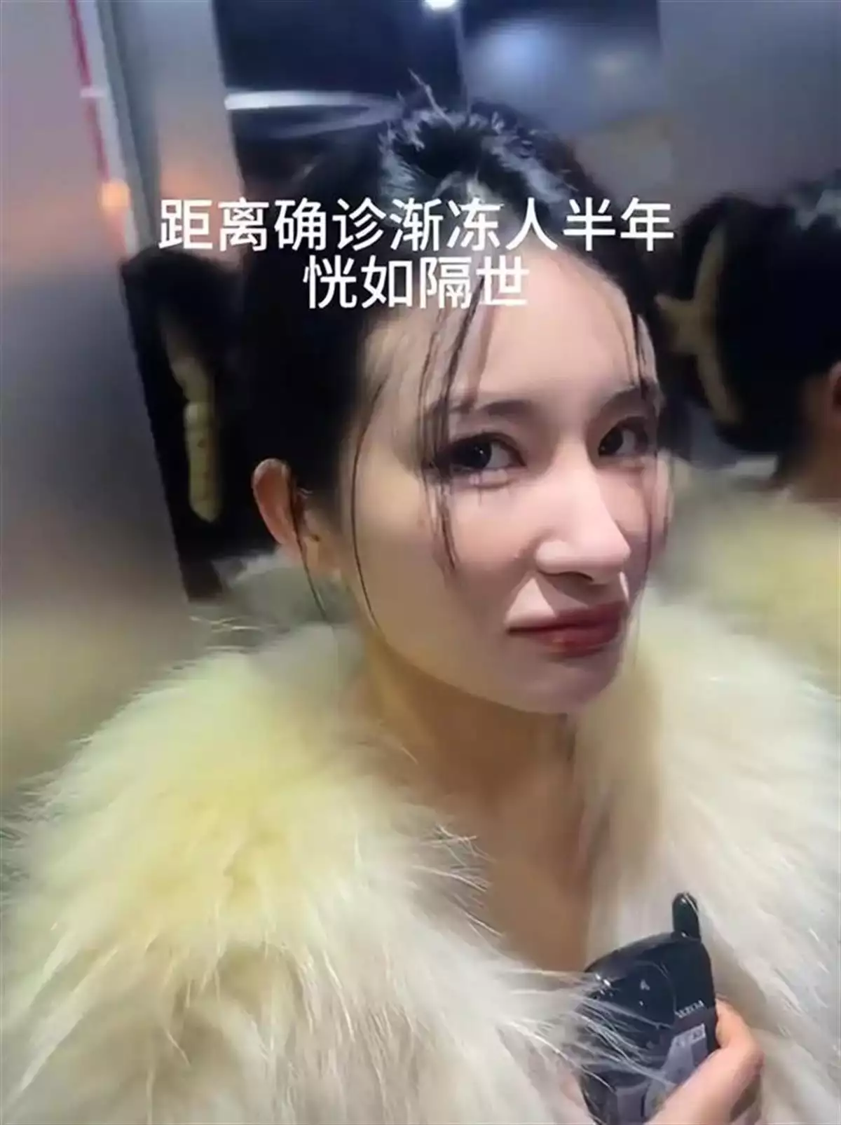 26歲漸凍癥女生確診僅一年離世，曾向蔡磊求助稱(chēng)等不到春天播報(bào)文章