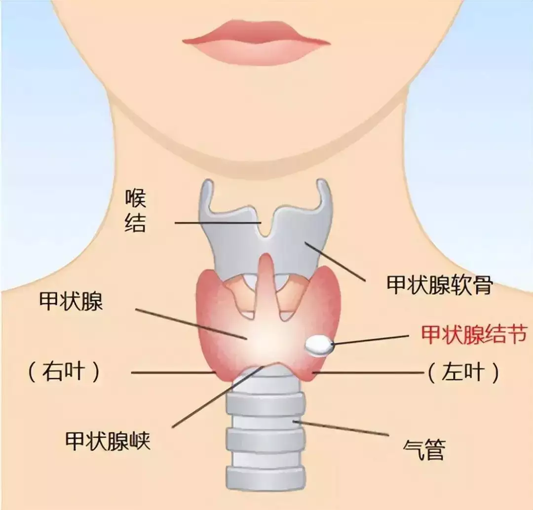 临近年底职工体检常查甲状腺，查出结节咋办？这招你得知道