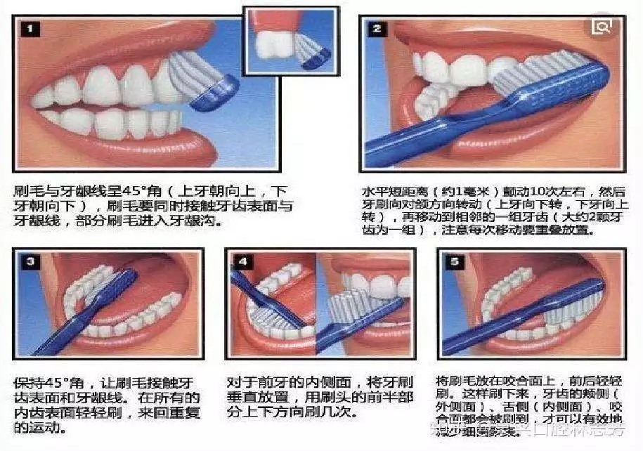 刷牙方式大不同，哪种对牙齿健康更有益？230年前法国女骗子真惨：被剥光了实施烙刑，周围全是看热闹的！