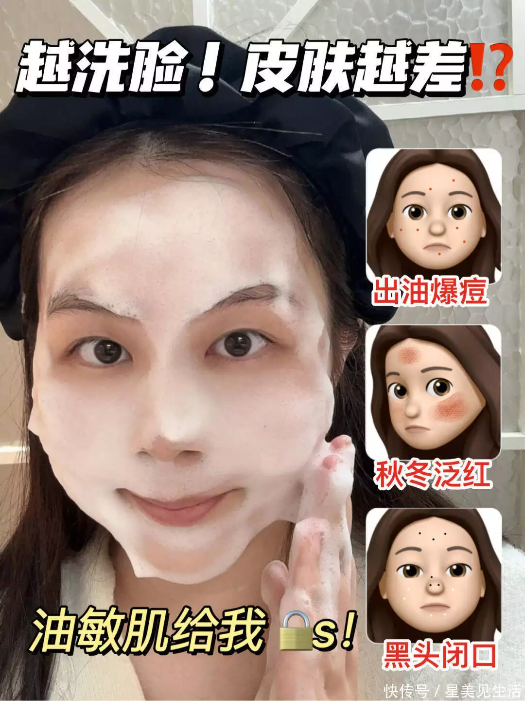 天然温和敏感肌护理产品_敏感肌肤护肤品推荐_透明质酸护肤功效