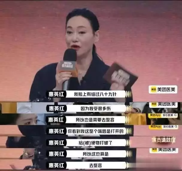 惠英紅自爆整過容，面部縫89針系因為...播報文章