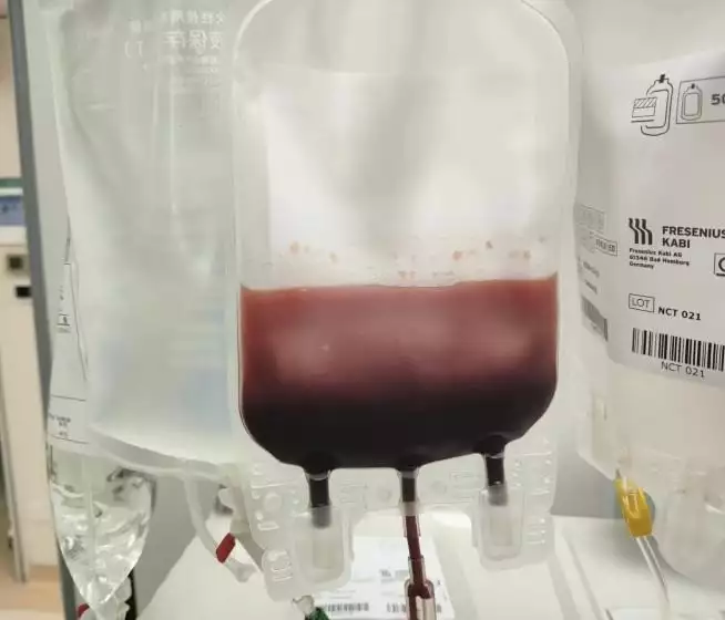 命运逆转！血液内科用这项前沿疗法为恶性肿瘤患者带来“重生之路”《风云》中颜值不输蒋勤勤，37岁还像高中生，屡次被曝说是同性恋（血液内科）肿瘤学治疗的前沿，