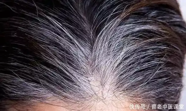 为什么白头发越长越多？不只是老了，或是缺乏了营养