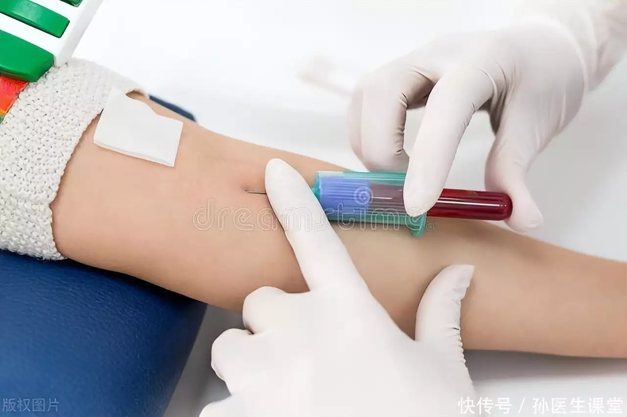 为什么去医院看病总是要抽血？抽血能查出哪些疾病？一文解答
