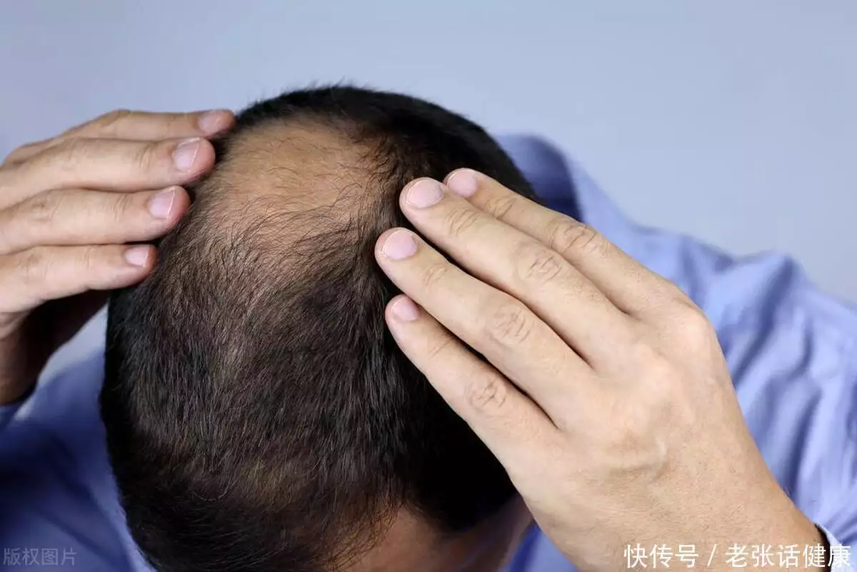 是什么造成了脱发？这4个原因，希望引起重视