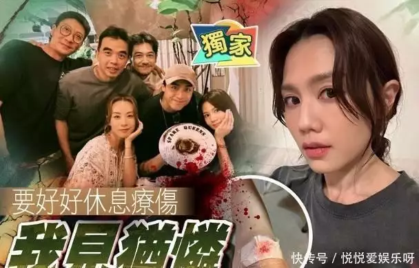 39岁周秀娜拍戏再度受伤，膝盖瘀伤一片，新电影已经杀青乱世佳人韦尼子：当过太子妃，做过李世民的嫔妃，晚年出家当尼姑