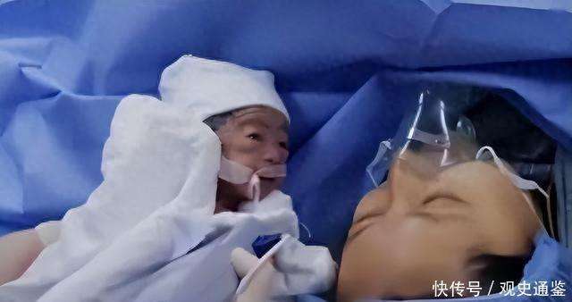 2017年,320斤重的女子舍命产子,医生扒开脂肪层抱出7斤重的男婴